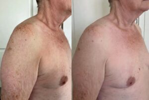 Never Ignore These 6 Weird Body Sags and Spots That Appear After Age 55 – The Hidden Truth Most Doctors Still Miss in 2026