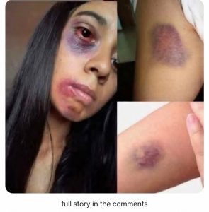 Heartbreaking News: Julia Roberts’ Unrecognizable Transformation Shocks Fans