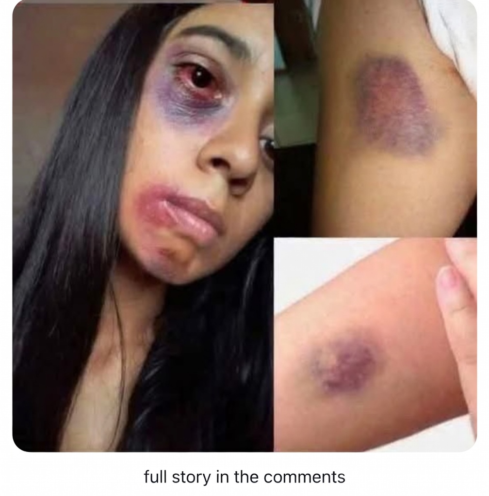 Heartbreaking News: Julia Roberts’ Unrecognizable Transformation Shocks Fans