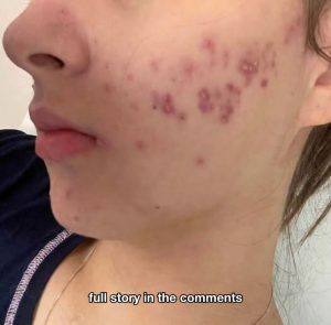 At 62, Sleeping With the Wrong Person Cost Him Retirement Savings