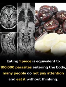 Eating Just One Bite Can Be Harmful – 8 Common Foods That May Carry Parasites & How to Protect Your Health After 40