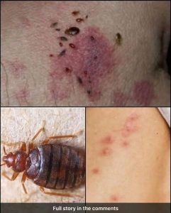 BE CAREFUL: If You Spot These Tiny Red Dots on Your Skin, See a Doctor Immediately