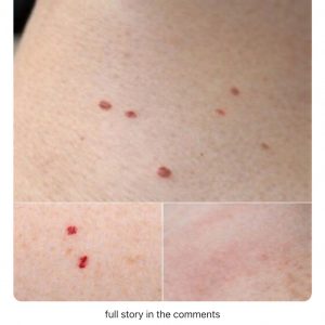 Red Dots on Your Skin – Causes and What They Could Mean
