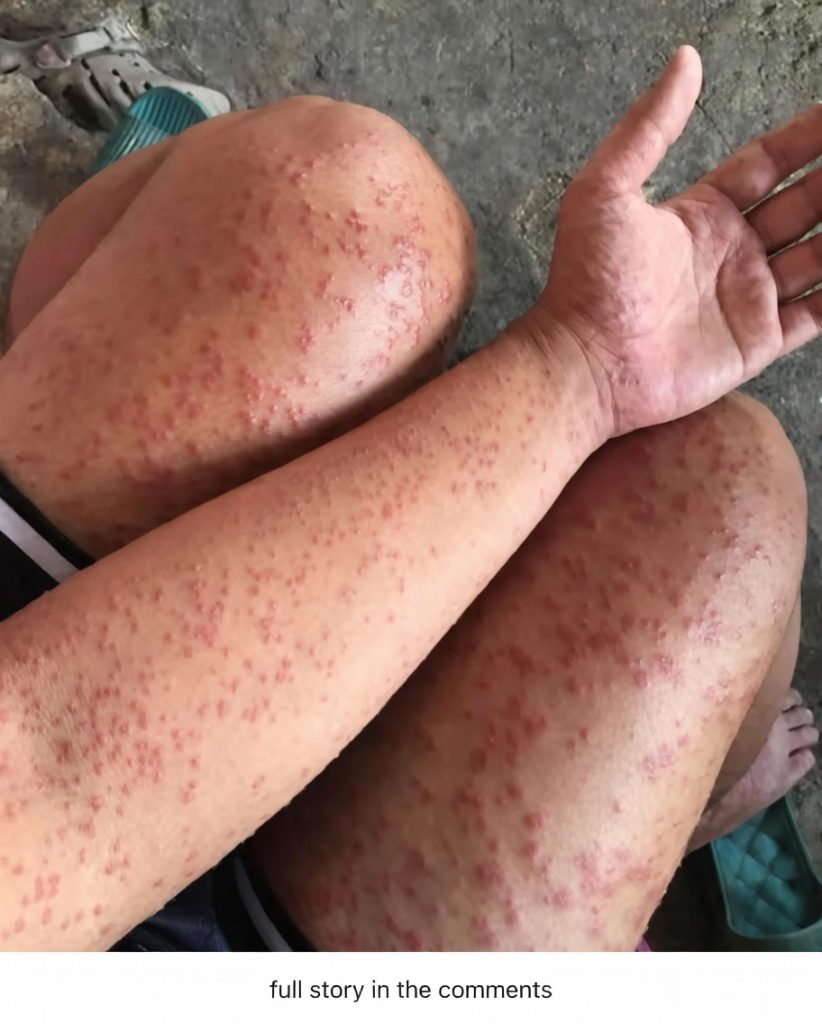 Think It’s Just Casual? What Really Happens When You Sleep With the Wrong Person