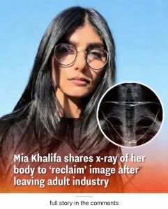 Mia Khalifa Posts X-Ray “Nudes” to Reclaim Her Public Image — Fans Divided