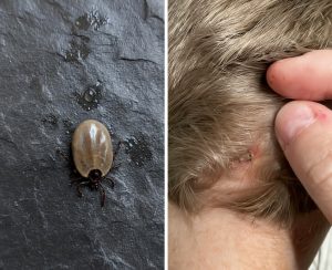 The Little Scalp Invader! 5 Common Bugs Parents Find in Kids’ Hair – What They Are, Why They Appear, and Exactly What to Do (2026 Guide)