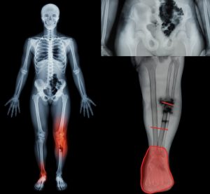 Understanding Health Concerns After Illness – What Older Adults Should Know! The Hidden Risks Doctors Are Now Warning Families About