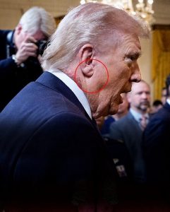 Frank’s Sign on Trump’s Ear Could Be a Huge Indicator of Potentially Fatal Health Condition — The Ceremony Photo That Sparked a National Debate on the President’s Well-Being