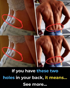 Understanding Lower Back Dimples A Natural Feature Of Human Anatomy