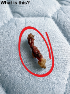 I Woke Up Feeling Something Strange On My Back What I Discovered Was Completely Unexpected