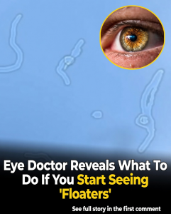 What Are Eye Floaters Here What To Do If You Start Seeing Them According To An Eye Doctor