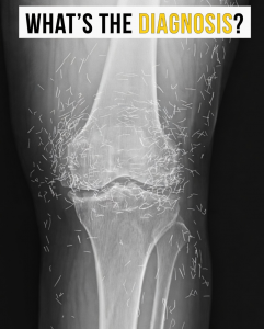 A Rare Medical Observation And What It Teaches About Joint Health Treatment Decisions And Patient Awareness