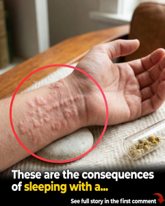 8 Sneaky Hives Triggers Hiding in Plain Sight – And How to Finally Stop the Itch for Good