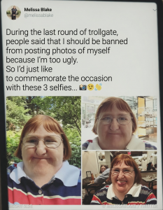 The Woman Bullied for Her Appearance Who Fought Back by Taking a Selfie Every Single Day for a Year – Her Story Is Changing Lives