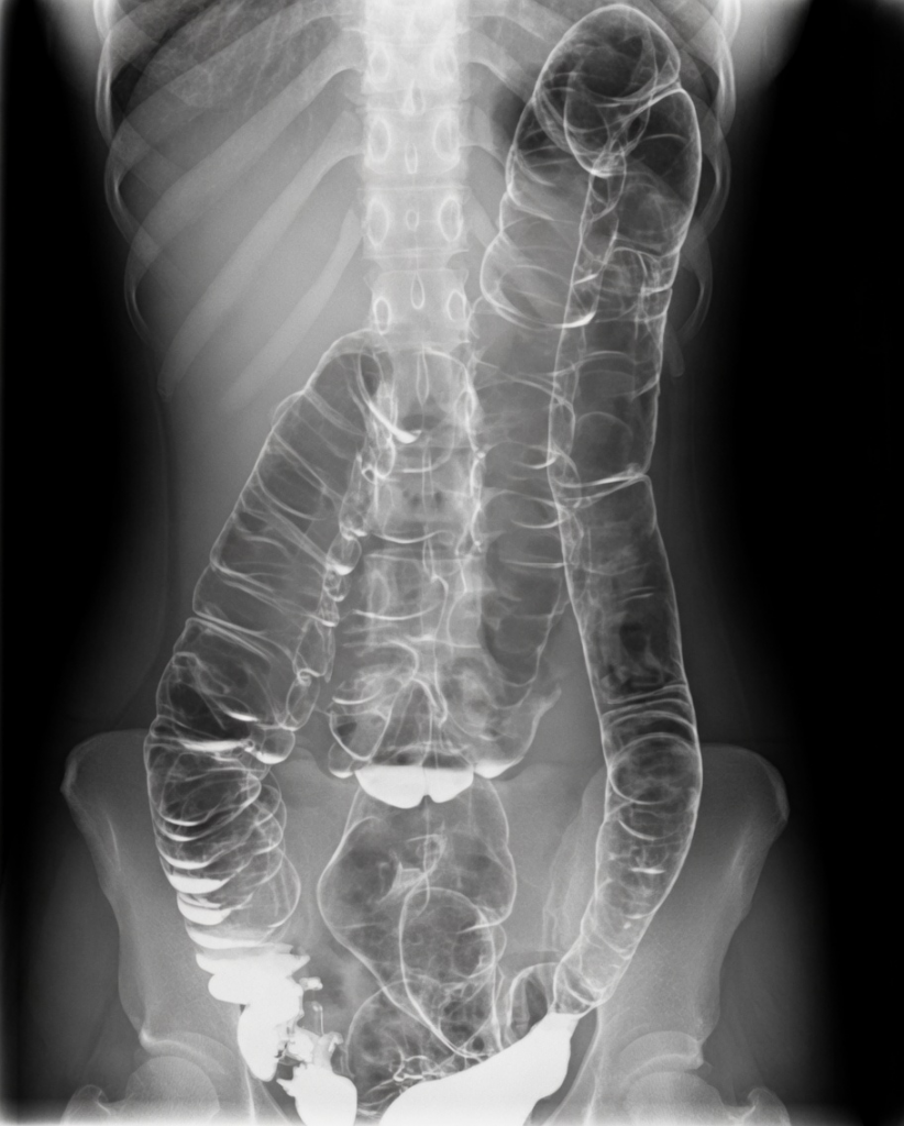 The Terrifying Hidden Medical Crisis Lurking Behind What You Think Is “Simple” Stomach Pain