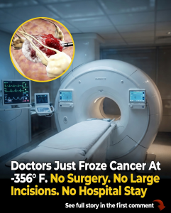 The Breakthrough Treatment That’s Changing How We Fight Cancer: MRI-Guided Cryoablation