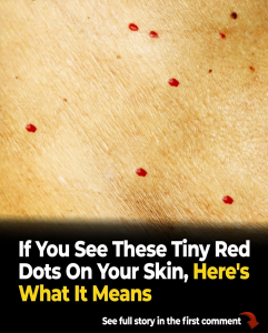 Red Dots on Skin: What They Really Mean and When You Should Be Concerned
