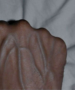 The Hidden Message Behind Your Visible Veins and Why You Should Never Ignore Them