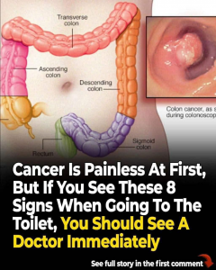 50 Weird Signs That Could Lead to a Cancer Diagnosis – What Your Body Is Trying to Tell You