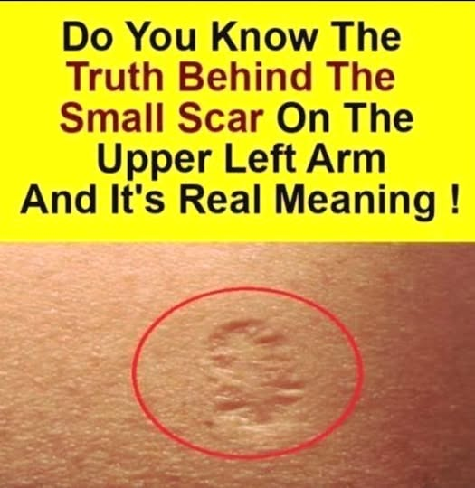 What Smallpox Vaccine Scars Look Like and Why They Appear