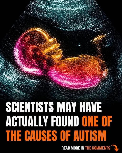 Study Identifies Possible Connection to Autism Development