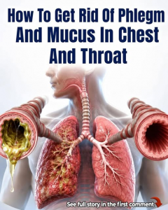 8 Ways to Get Rid of Phlegm and Mucus in Chest and Throat