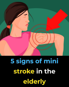 That “Minor” Dizzy Spell Could Be Your Brain’s Desperate Warning of a Mini-Stroke—Here’s Why You Must Never Ignore It