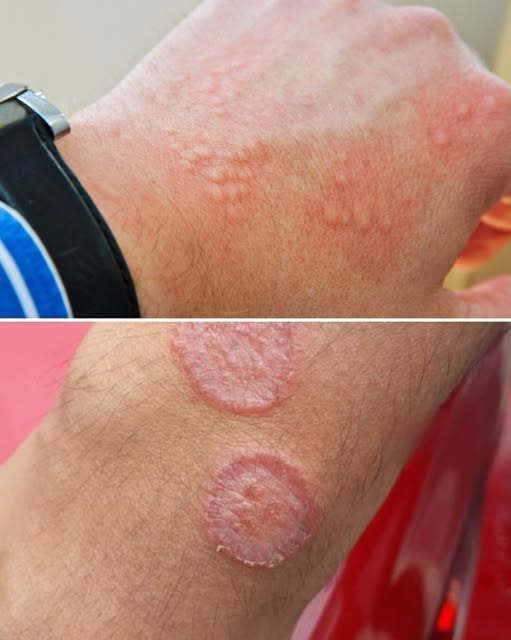 That Persistent Groin Irritation Might Be More Than Just a Minor Annoyance — Here’s What You Need to Know
