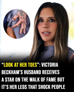 The Painful Price of Fashion: Victoria Beckham’s Walk of Fame Appearance Sparks Horrifying Health Concerns
