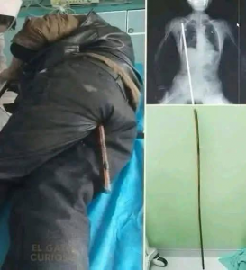 Shocking Police Custody Crisis: Young Man Left Fighting for His Life After Routine Arrest Gone Wrong