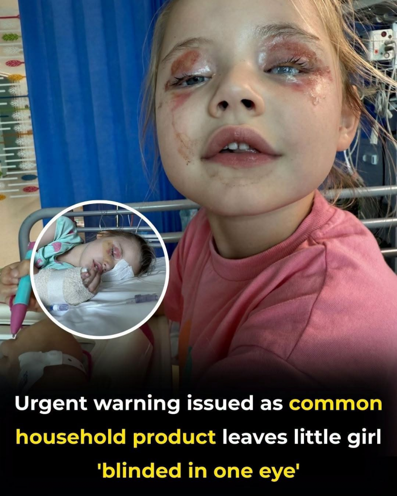 YOUR LAUNDRY ROOM IS A DEATH TRAP: THE COMMON HOUSEHOLD ITEM THAT NEARLY BLINDED THIS CHILD