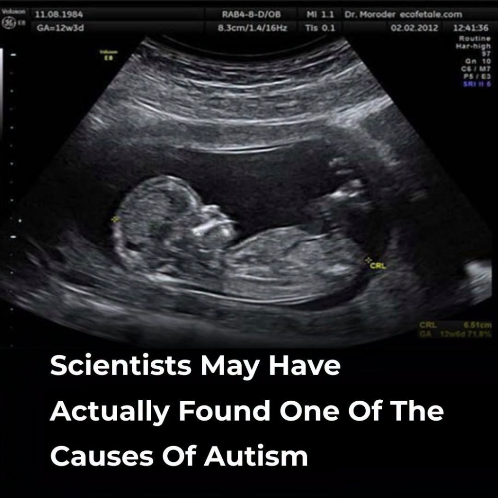 The Hidden Maternal Link: Scientists May Have Finally Unlocked the Gut Microbiome Secret Behind Autism