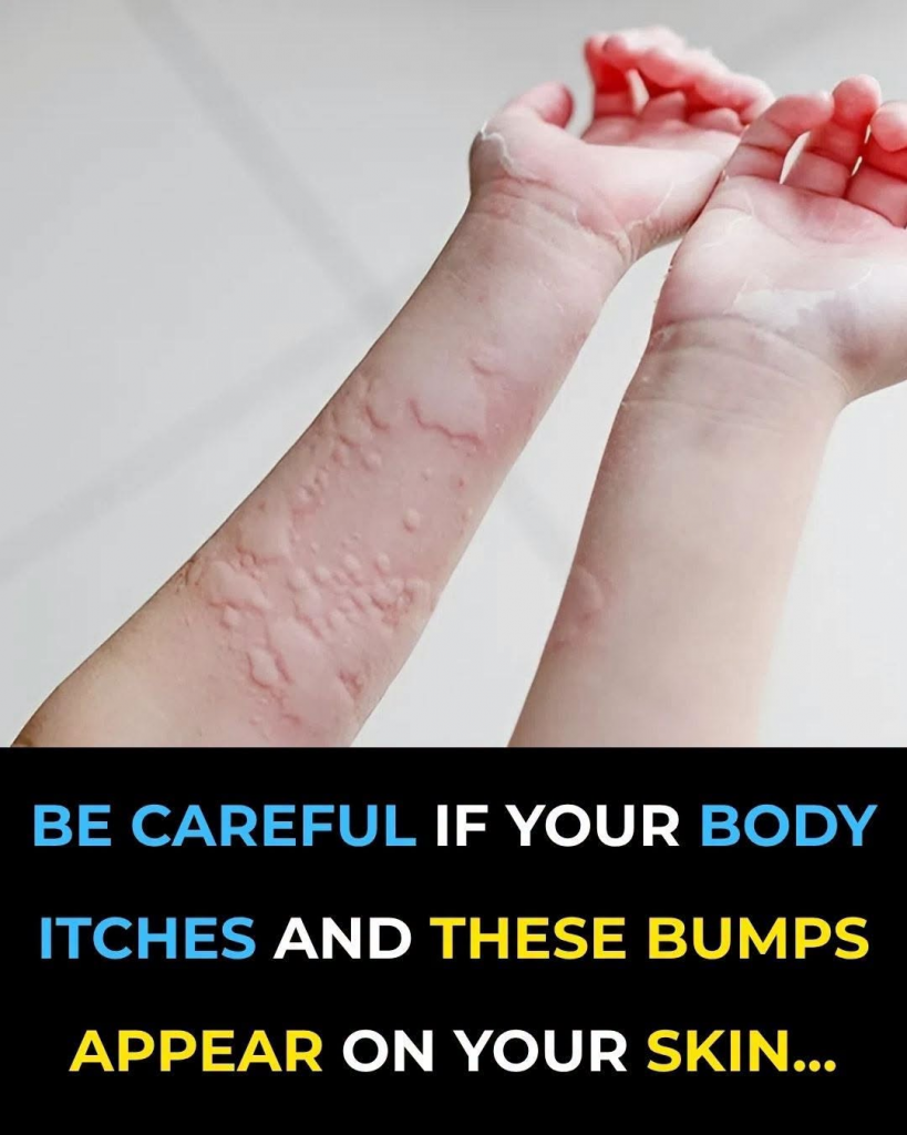 The Itchy Nightmare That Won’t Go Away: 7 Hidden Triggers Turning Your Skin Against You